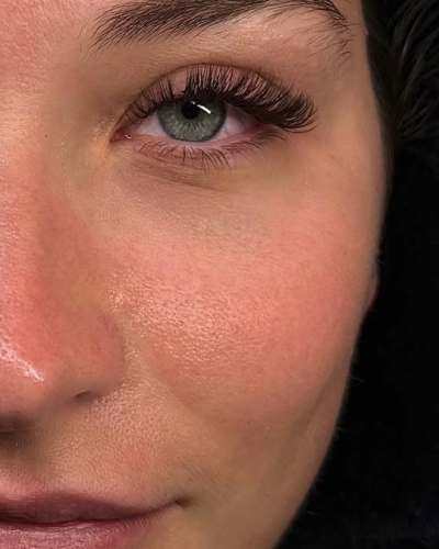 extensions mixte nice