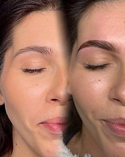 browlift avec teinture nice
